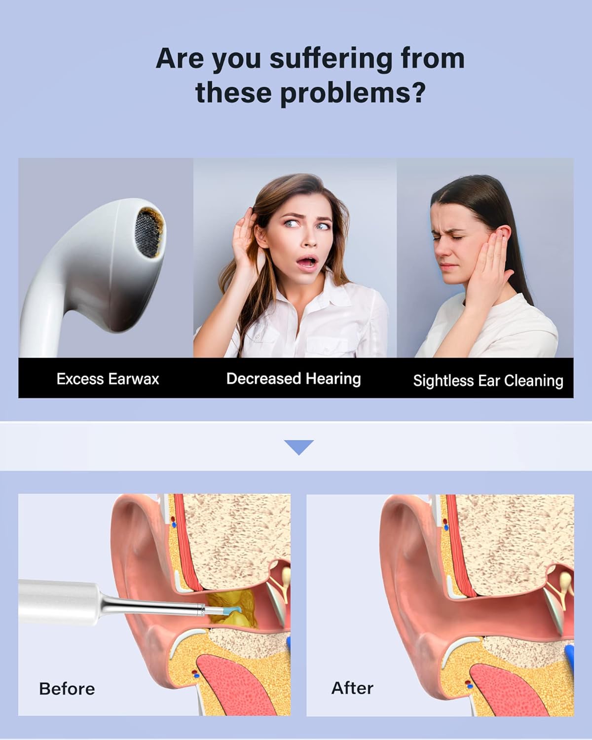 Limpieza de oídos inalámbrica BEBIRD C3